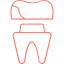 Porcelain Veneers
