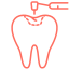 Dental Fillings